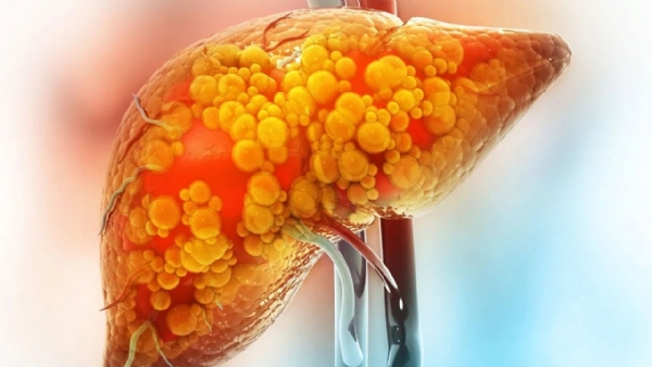 These 5 Vegetables Naturally Reverse Fatty Liver Fast! These 5 Vegetables Naturally Reverse Fatty Liver Fast!