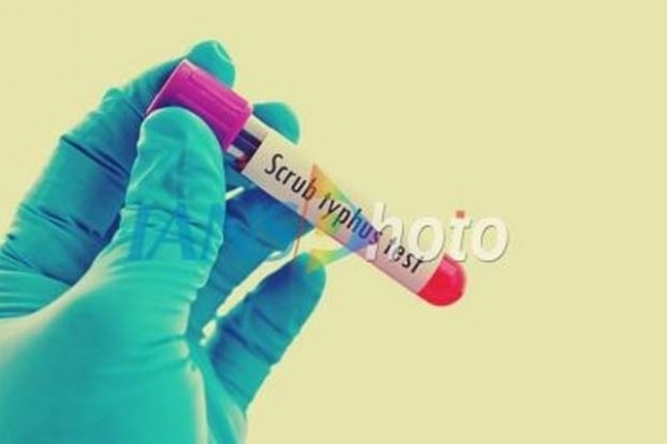 /scrub-typhus-outbreak-grips-andhra-pradesh-all-26-districts-affected /scrub-typhus-outbreak-grips-andhra-pradesh-all-26-districts-affected