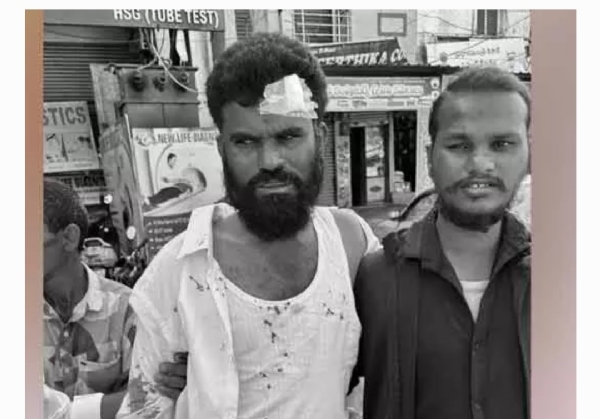 పోలింగ్ ఘర్షణ పోలింగ్ ఘర్షణ