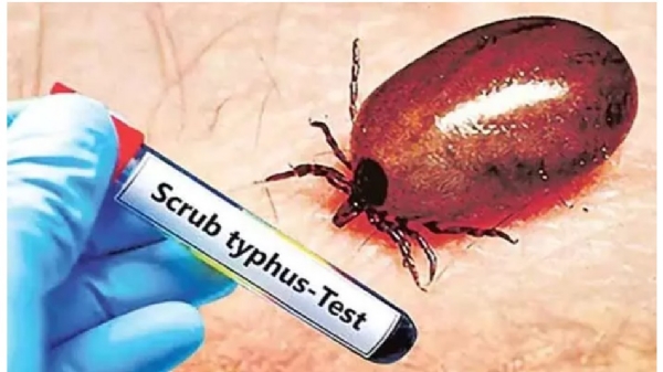 scrub-typhus-is-spreading-in-ap-505142 scrub-typhus-is-spreading-in-ap-505142