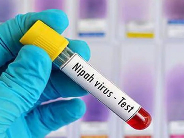 Nipah virus