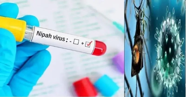 Nipah virus