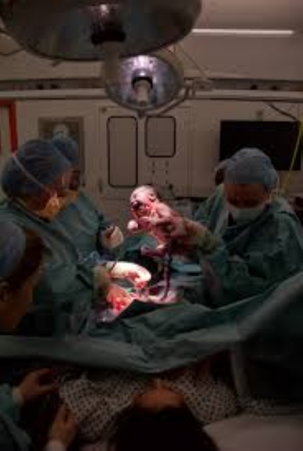 c section c section
